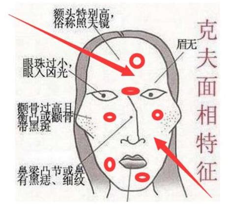 耳後有痣暗藏財|7個招桃花、招財「痣」介紹！耳朵痣錢途不可限量，。